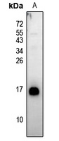 Anti-Neuromedin B Antibody