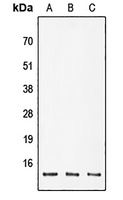 Anti-POLR2K Antibody