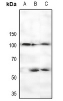 RBBP8 (phospho-S327) antibody