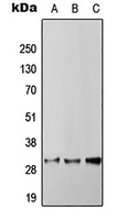 RGS4 antibody