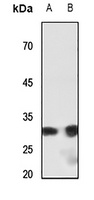 Anti-SHOX Antibody