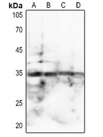 SPARC antibody