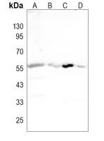 Anti-SSTR2 Antibody