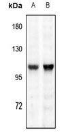 Anti-TRPV1 Antibody