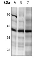 TNFRSF10B antibody