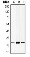 Anti-CIB1 Antibody
