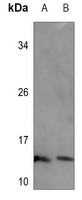 Anti-SEC61B Antibody