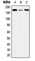 Anti-CIC Antibody