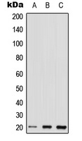 RHOQ antibody