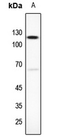 NNT antibody