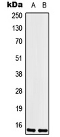 Anti-LSM1 Antibody