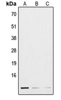 Anti-POLR3K Antibody