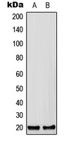 Anti-CFC1B Antibody