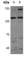 STK31 antibody