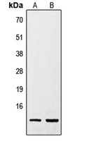 Anti-Resistin Antibody