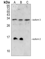 Anti-MOB2 Antibody