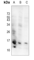 Anti-EG-VEGF Antibody