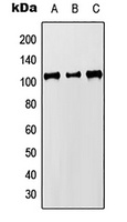 Anti-MCM8 Antibody