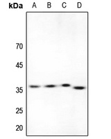 Anti-ACER1 Antibody