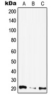 Anti-CIB4 Antibody