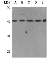 Anti-Collagen 26 alpha 1 Antibody