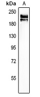 Anti-Agrin Antibody