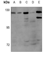 Anti-Androgen Receptor (Phospho-S650) Antibody