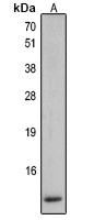 Anti-Defensin beta 2 Antibody