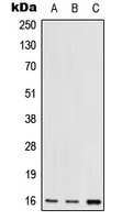 Anti-RPS17 Antibody