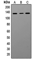 ADAR antibody