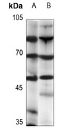 Anti-Beta-2 Adrenergic Receptor Antibody