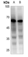 Anti-Beta-2 Adrenergic Receptor Antibody