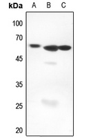 AIRE antibody