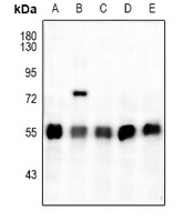 Anti-ATF4 (Phospho-S245) Antibody