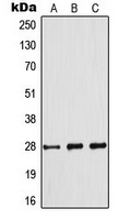 Anti-BCL2 (Phospho-S70) Antibody