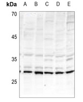 Anti-BIK (Phospho-T33) Antibody