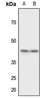 CD147 antibody