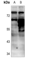 Anti-BTK (Phospho-Y223) Antibody