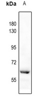 CAT antibody