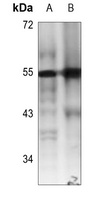 RUNX1 antibody