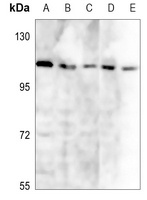 Cadherin-17 antibody