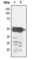 CHRNA1 antibody