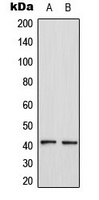 CCR4 antibody