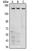 Collagen IV antibody