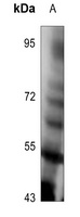 Anti-TPL2 (Phospho-T290) Antibody