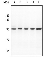 Anti-ATF6B Antibody