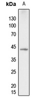 Anti-p38 (Phospho-T180) Antibody