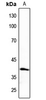Anti-CK1 alpha Antibody