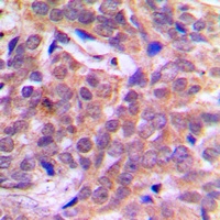 Beta-catenin (Phospho-S37) Rabbit Polyclonal Antibody