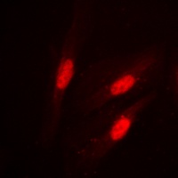 Beta-catenin (Phospho-S37) Rabbit Polyclonal Antibody